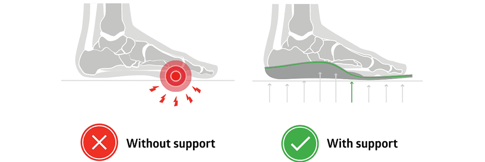 Metatarsal Support insole
