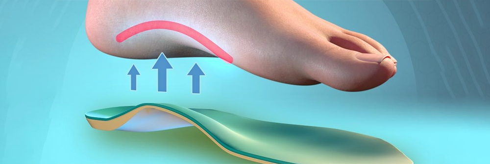 What_Is_a_Plantar_Fasciitis_Insole