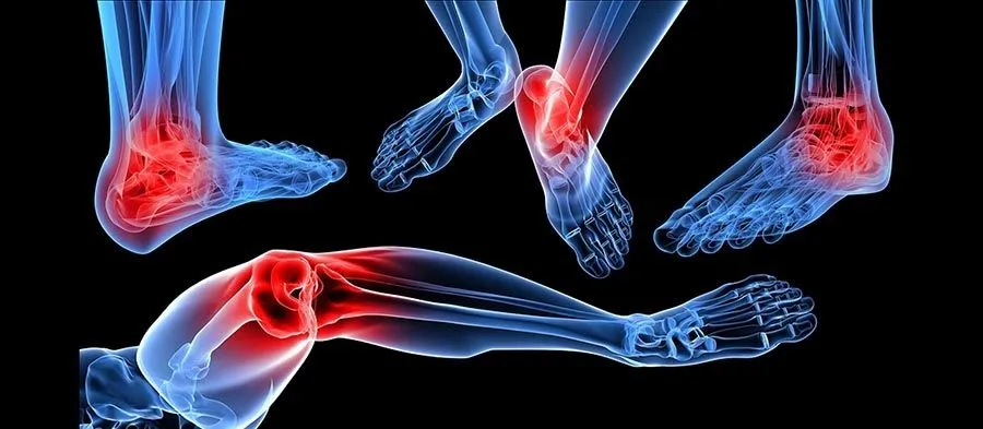 The Running Doctor: Prevention and treatment of Arthritis