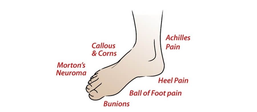 8 Common Foot Problems